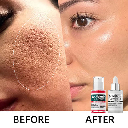 Shrinks Pores & Fades Blemish Marks