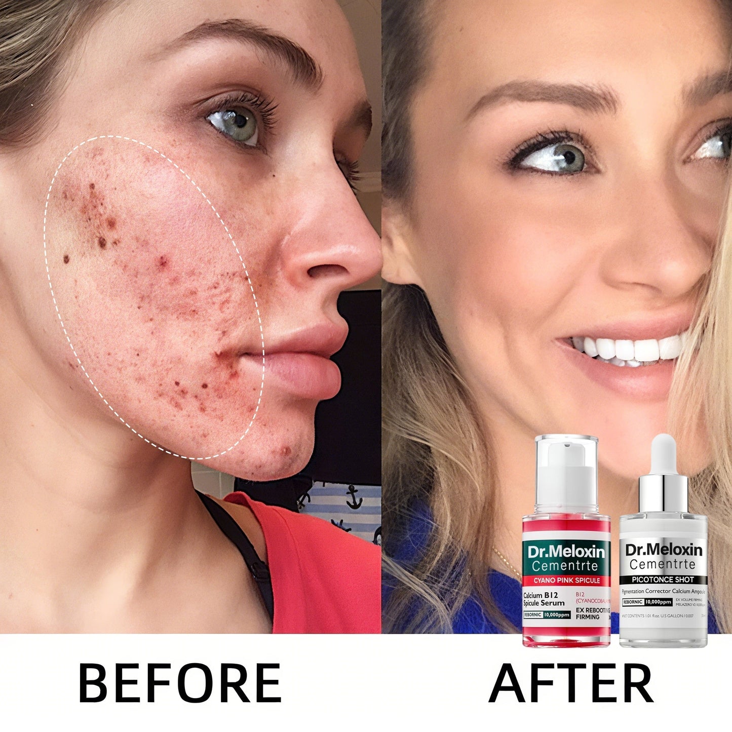 Shrinks Pores & Fades Blemish Marks